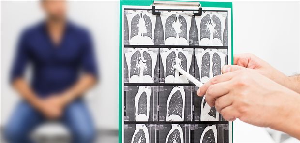 CT-Scan einer Lunge.