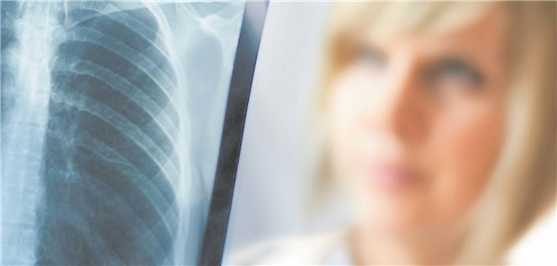 Lungenkrebs? Die Überlebensraten sind in den vergangenen Jahren deutlich gestiegen.