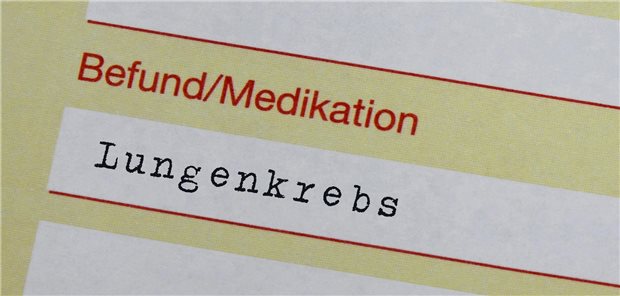 Lungenkrebs so früh wie möglich erkennen und damit die Heilungschancen erhöhen helfen soll das neue Früherkennungsprogramm, das der G-BA beschlossen hat.