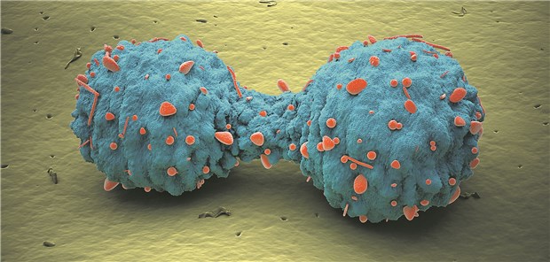 Lungenkrebszellen. Auch bei fortgeschrittenem NSCLC haben sich die Therapiechancen verbessert.