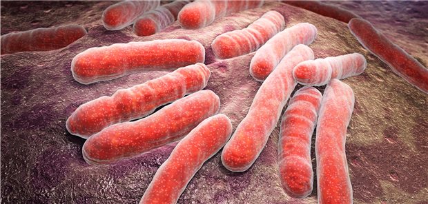 Wird die latente Tuberkulose aktiv? So wird es berechnet! Aufnahme von Mycobakterium tuberculosis im Elektronenmikroskop: Rund 25 Prozent der Bevölkerung sind latent mit Tuberkulose infiziert.