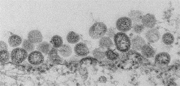 Mehr MERS-Tote und eine Hypothese MERS-CoV in grau: In Saudi-Arabien sind daran weit mehr Menschen gestorben als bislang bekannt war.