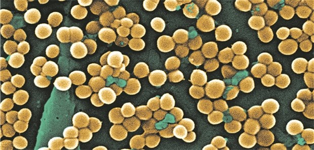 Phagentherapie – Startschuss für eine koordinierte Forschung in Deutschland MRSA: Könnten Bakteriophagen eine Option gegen resistente Keime sein?