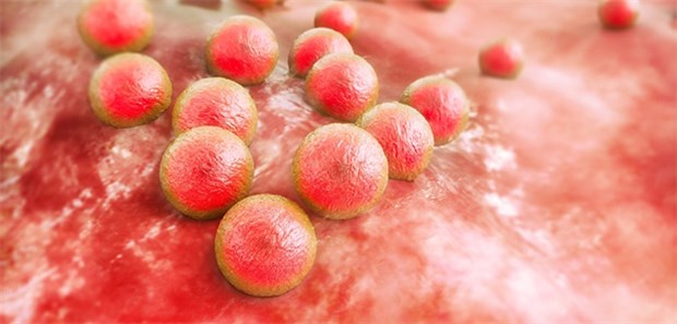 MRSA (Methicillin-resistenter Staphylococcus aureus): Infektionen mit dem Keim kommen zunehmend auch außerhalb von Kliniken vor.