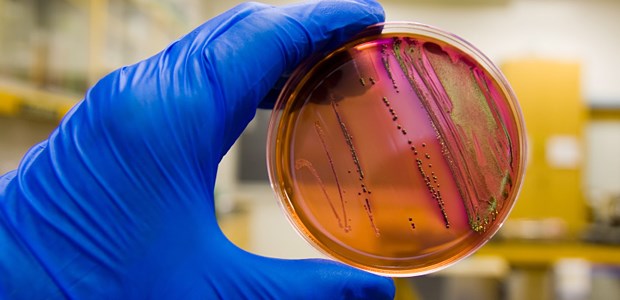 Kliniken kritisieren Kassen-Studie MRSA-Nachweis im Labor: In Bremen gibt es Streit um Infektionszahlen.