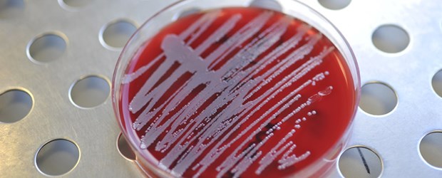 Fünf Länder verfehlen Hygiene-Ziele MRSA - ein Problem für Kliniken. Fünf Länder hinken bei den Hygieneverordnungen hinterher.