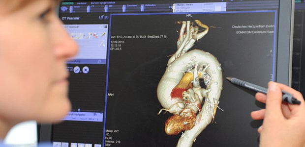 Weiter hohe Sterberate nach Gefäßruptur MRT-Darstellung: Aneurysma der Aorta ascendens.