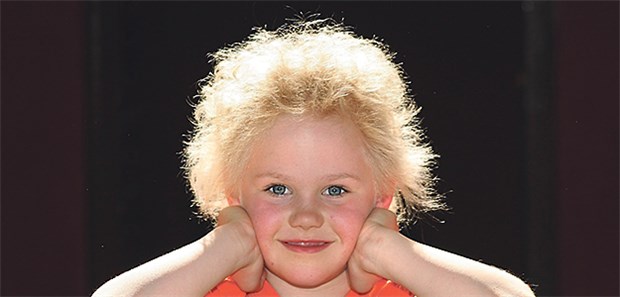 Ärzte entdecken Grund für Struwwelpeter-Syndrom Mädchen mit Struwwelpeter-Syndrom: Mutationen führen dabei zu Haar-Anomalien.