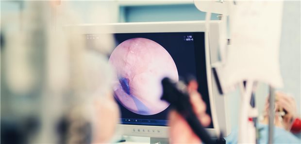 Darmkrebsprävention: Längerer Abstand zwischen zwei Koloskopien ist sicher Männer haben bekanntlich bereits ab einem Alter von 50 Jahren Anspruch auf eine Koloskopie, da sie ein höheres Risiko als Frauen haben, an Darmkrebs zu erkranken. Bei Frauen liegt die Altersgrenze für die Koloskopie bei 55 Jahren.