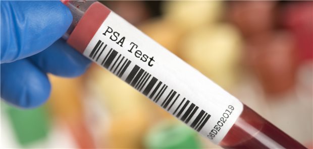 Männer regelmäßig auf Prostata-spezifisches Antigen (PSA) zu screenen, zahlt sich aus.