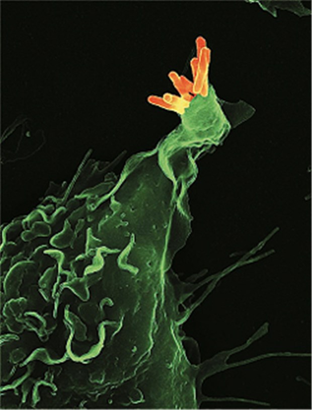 Initiative gegen Tuberkulose bei HIV Makrophage mit Mycobacterium tuberculosis.
