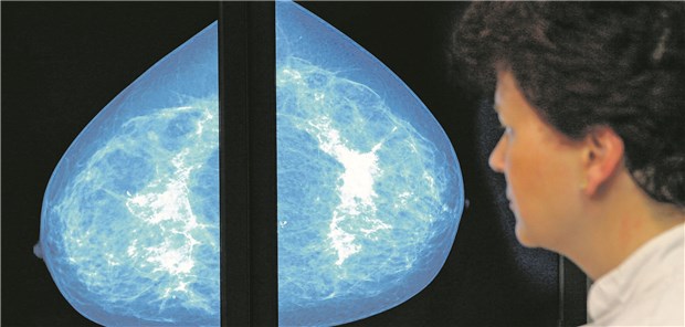 Ärzte im Zeitalter von Fake News, Fake Science und bald Fake Findings? Mammografie-Befundung: Sind die Bilder echt oder manipuliert?