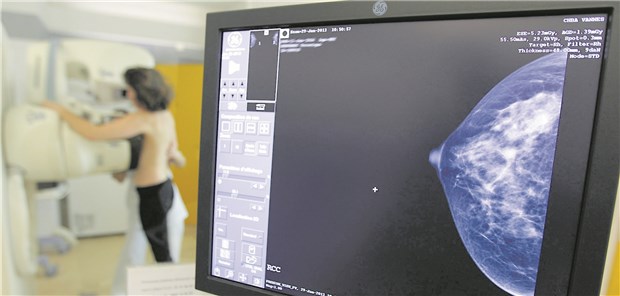 Die Krebsgefahr durch Mammografie Mammografie: Die Screening-Programme unterscheiden sich von Land zu Land.