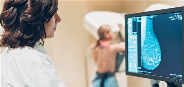 Mammografie: Um die volle Schutzwirkung zu erhalten, sollten alle Screening-Termine wahrgenommen werden.