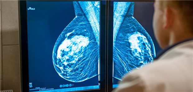 Mammogramm: Trotz vollständiger operativer Entfernung eines DCIS ist das Risiko, langfristig an Brustkrebs zu sterben stark erhöht, - besonders hoch ist es bei jung erkrankten sowie dunkelhäutigen Frauen.