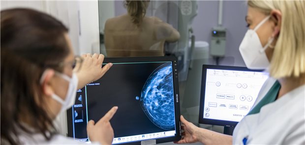 Mammographie-Screening: Patientinnen, die ihre Vorsorgetermine wahrnehmen, erkranken seltener an Brustkrebs höherer Stadien.