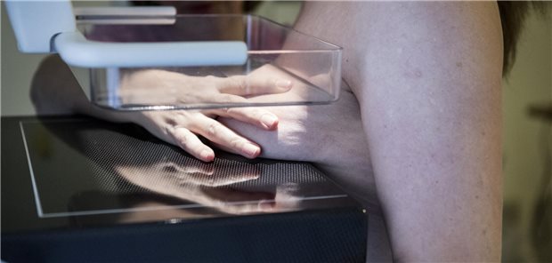 Mammographie in der Praxis