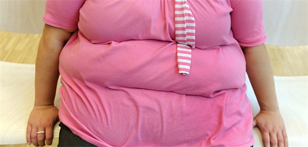Bariatrische Op auch ohne Zusage der Kasse? Manche Adipositas-Patienten brauchen ihrer Gesundheit wegen dringend eine Op, doch die Kassen wollen nicht zahlen. Für Ärzte eine schwierige Situation.