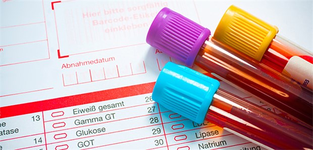 Manche Laborleistungen gehen nicht in die Laborkosten ein.