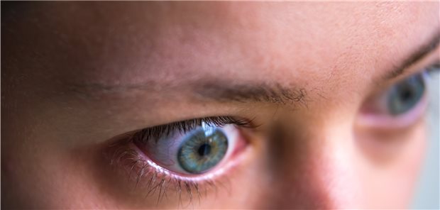 Erkrankungen von den Augen ablesen – das sind mögliche Zeichen Manche innere Erkrankung zeigt sich schon früh durch Symptome und Beschwerden an den Augen.