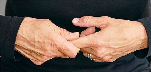 Darum knacken manche Finger Manche können nicht ohne, manchen graut´s davor - das Fingerknacken.