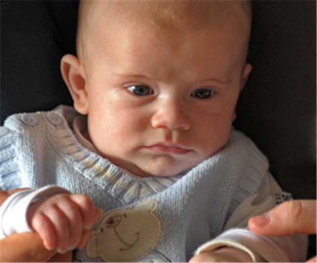 Verpflanztes Eierstockgewebe erfüllt Kinderwunsch Maximilian, drei Monate alt.