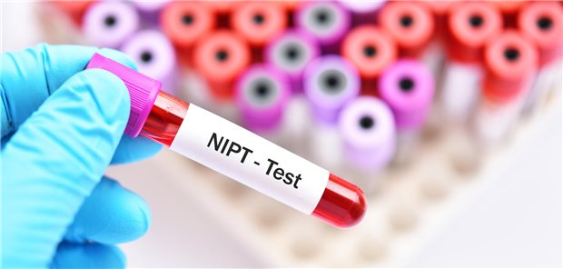 Medizinethisch und politisch umstritten: Pränataldiagnostik NIPT.