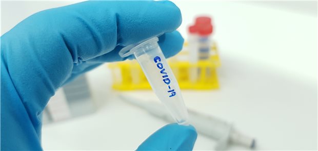 mRNA – der schnellste Weg zum Corona-Impfstoff? Mehr als 70 Impfstoffkandidaten gegen COVID-19 befinden sich in der Pipeline.