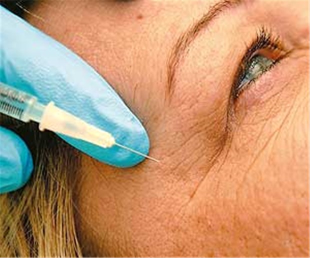 Botulinumtoxin wird immer gefragter Mehr als 70.000 Menschen ließen sich ihre Falten 2010 wegspritzen, so die Gesellschaft für Ästhetische Chirurgie.
