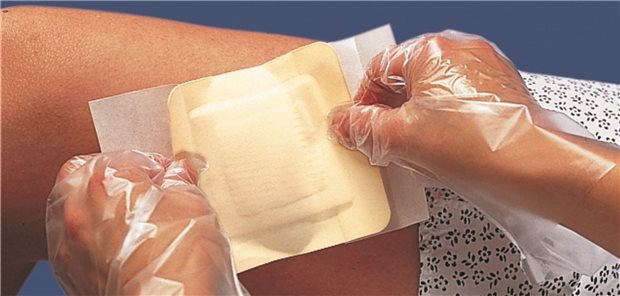Mehr als nur ein Verband: Antimikrobiell beschichtete Auflagen sollen vor allem bei schlecht heilende Wunden helfen. Allerdings will der G-BA in absehbarer Zeit dafür Nutzennachweise sehen.