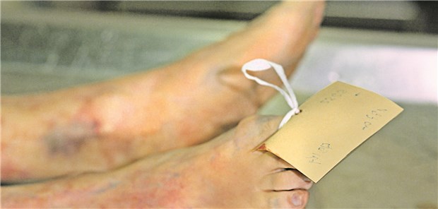 Meist geht es ohne Skalpell: Bei der äußeren Leichenschau wird geprüft, ob es Anzeichen eines unnatürlichen Todes gibt.