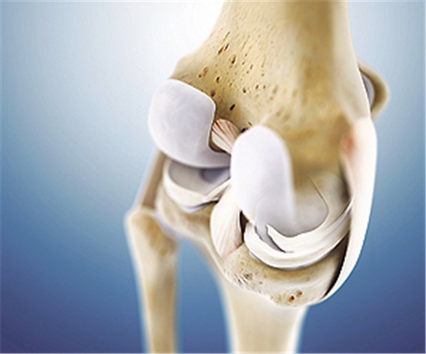 Bei altersbedingten Meniskusschäden kein Nutzen Menisken: Selbst bei Patienten, deren Knie nur leichte Arthroseschädenaufweisen, nützt eine Op wenig.