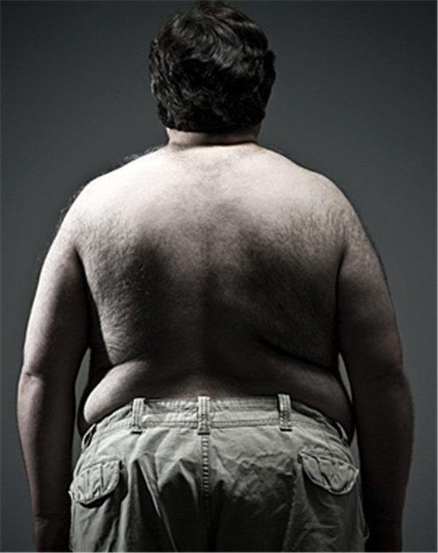 Übergewicht und chronische Schmerzen hängen zusammen Menschen mit einem BMI von 30 und mehr haben häufiger Schmerzen als Normalgewichtige.
