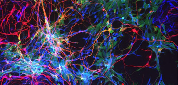 Deshalb haben Menschen ein großes Hirn Menschliche kortikale Zellen in vitro 2. Zwei Forschergruppen haben eine Antwort auf die Frage gefunden, weshalb das Gehirn des Menschen etwa dreimal so groß ist wie das seiner nächsten Verwandten.