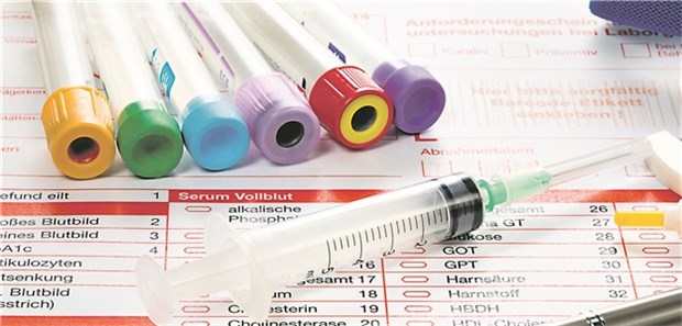 Messung des Cholesterins: Es lässt sich mit den heutigen Therapien auf sehr niedrige Werte senken.