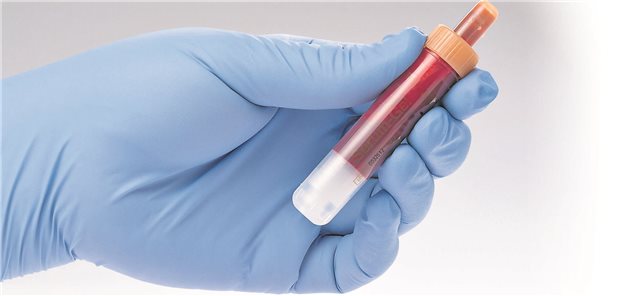 Ein Arzt hält eine Blutprobe in der Hand.