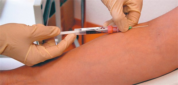 Metformin hatte in einer Studie einen positiven Effekt auf die Cholesterinwerte von Typ-2-Diabetikern.