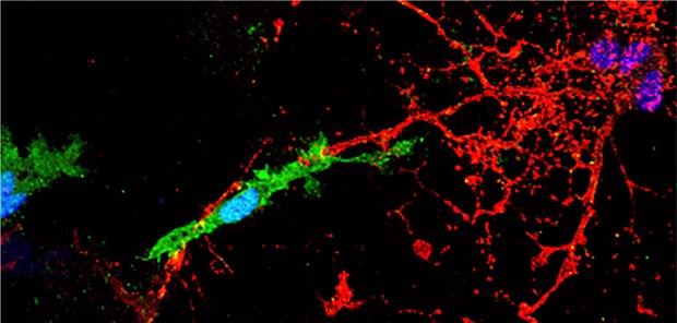 Mikrogliale Zelle (grüne) kontaktiert und attackiert mylinisierte Axonfortsätze (rot) in dem axonalen Schädigungsszenario. Im Beisein der HERV-W-Hüllproteins fürht dies zu axonalem Schaden.