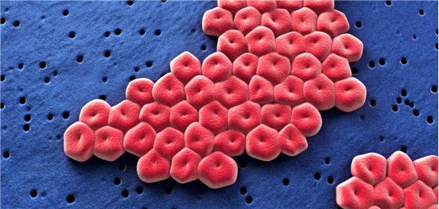 Mikroskopaufnahme einer Kolonie von Acinetobacter baumannii