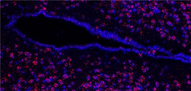 Mikroskopie eines Hypothalamus-Hirnschnitts. Zu sehen ist der dritte Ventrikel (schwarz). Die roten Punkte zeigen den Rezeptor und die Zellkerne sind blau eingefärbt.