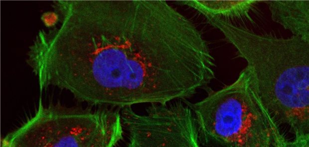 Mikroskopische Ansicht menschlicher Eierstockkrebszellen – durch die Immunfluoreszenzfärbung erscheinen Zellkerne blau und das Zellskelett grün. 