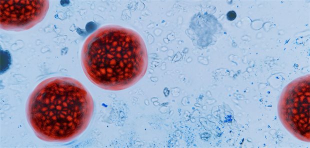 Rot angefärbte Oozysten von Cyclospora cayetanensis unter dem Mikroskop.