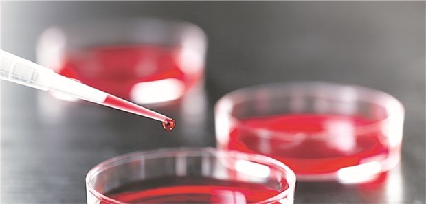 Neue Methoden zur Regeneration von Myokardgewebe Milliarden Herzzellen können in der Kulturschale produziert werden.