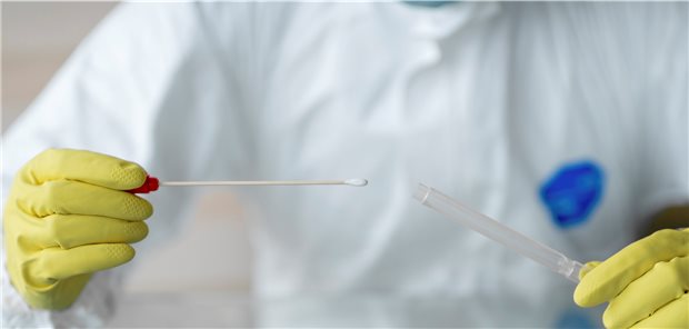 Milliarden SARS-CoV-2-Tests weltweit: In den Börsennotierungen der Testproduzenten hat sich das nur bedingt niedergeschlagen. Mladen Sladojevic / Getty images