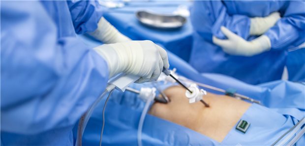 Minimalinvasive Cholezystektomie: Eine Konversion zur offenen Op erfolgte umso häufiger, je weniger Eingriffe auf einen Operateur bzw. auf ein Krankenhaus kamen.
