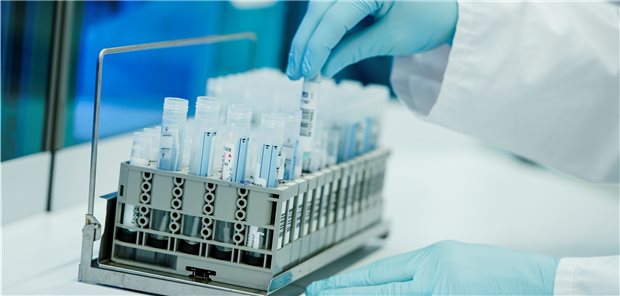 Corona-Tests: Positivrate auf Allzeithoch Mit 56,4 Prozent ist die Positivrate der SARS-CoV-2-PCR-Tests in der vergangenen Woche auf einen neuen Rekordwert geklettert.