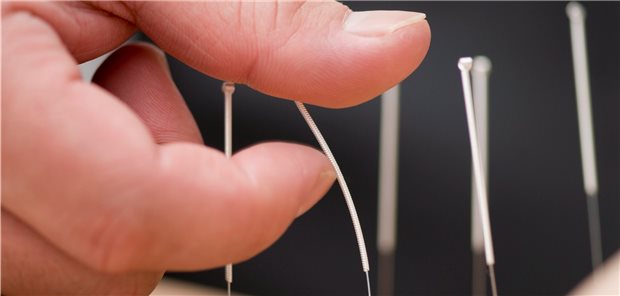 Mit Akupunktur lässt sich die Intensität von Hitzewallungen verringern.