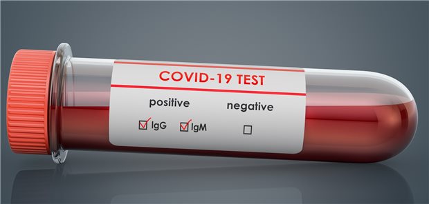 „Antikörpertests eignen sich nicht zum Immunitätsnachweis“ Mit Antikörpertests werden in der Regel Immunglobuline M und G erfasst.