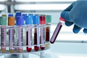 Infektionsschutz auf der Abschussliste? Mit Barcode lassen sich die Proben den Aufträgen zuordnen. Der Ärger mit der Abrechnung bleibt.