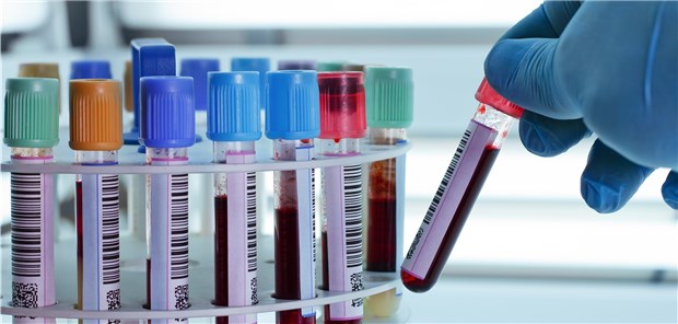 TSH beim Diabetiker? „Das geht jetzt voll auf meine Kappe“ Mit Barcode lassen sich die Proben den Aufträgen zuordnen. Der Ärger mit der Abrechnung bleibt. angellodeco / stock.adobe.com